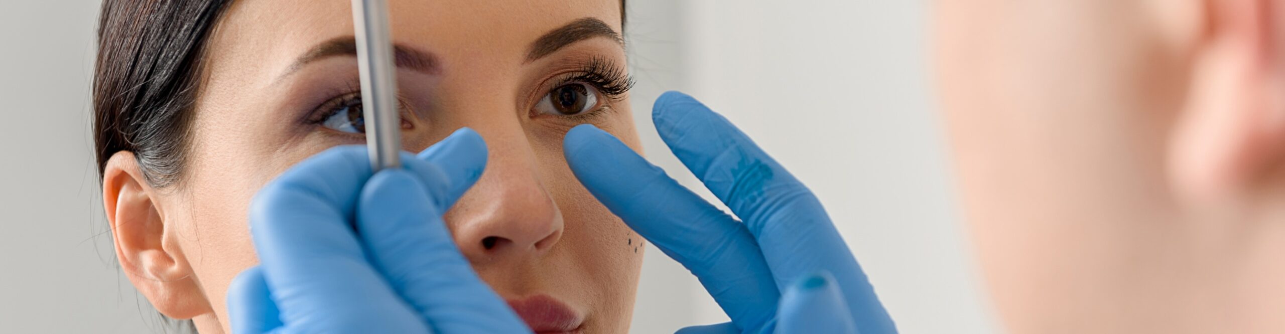 Chirurgie du nez après un traumatisme : comment retrouver un nez harmonieux ?