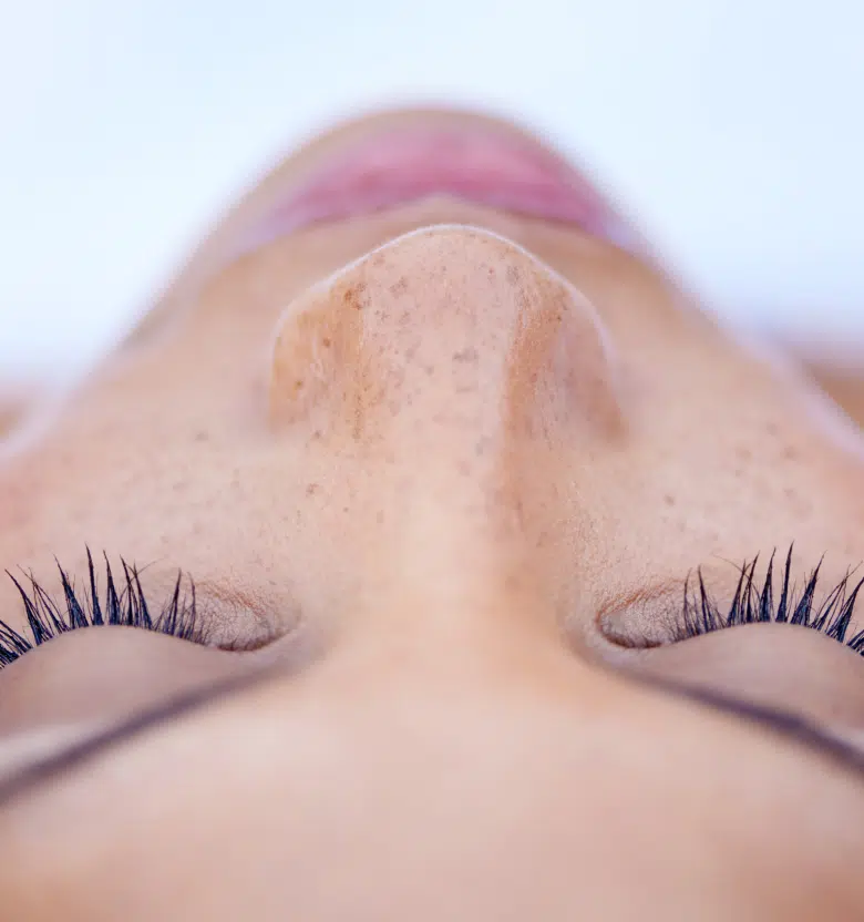 rhinoplastie ultrasonique technique plus précise sûre remodeler nez | Centre Phocet | Marseille