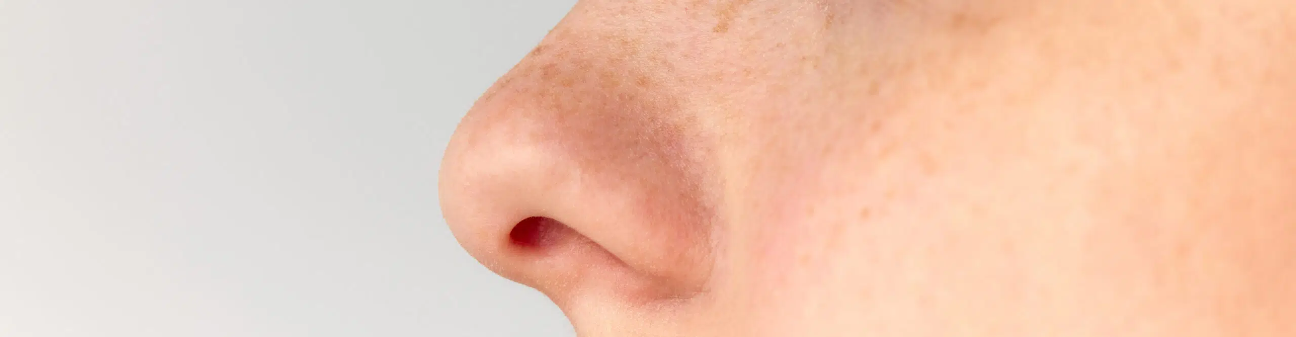 Qu’est-ce qu’une rhinoplastie médicale et pour qui est-elle adaptée ?