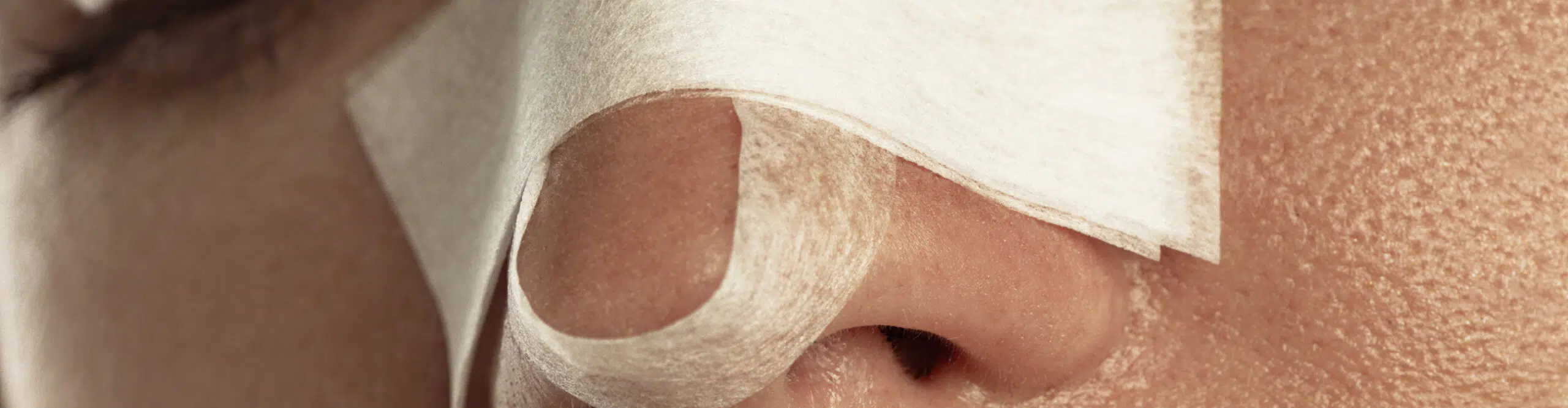Récupération après une rhinoplastie chirurgicale : conseils et précautions