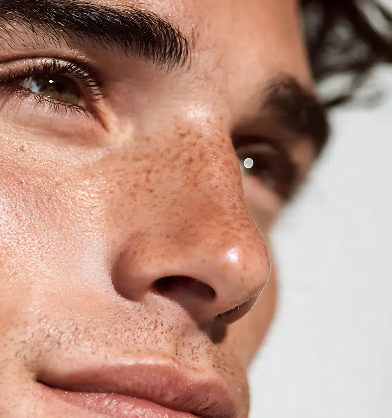 Rhinoplastie chirurgicale hommes spécificités | Centre Phocet | Marseille